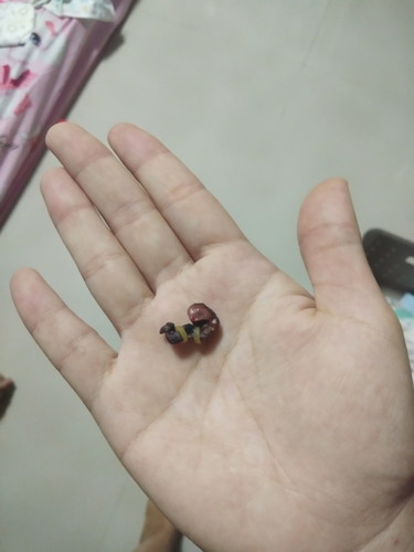 สะดือหลุด