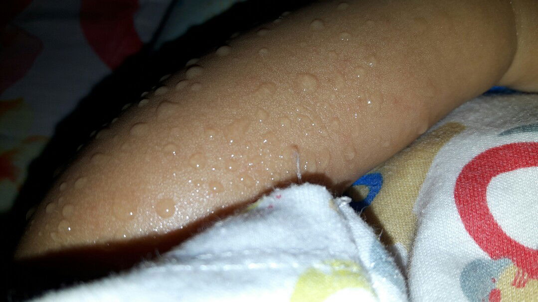 keringat banyak sekali. ganti baju bisa 7-10x sehari