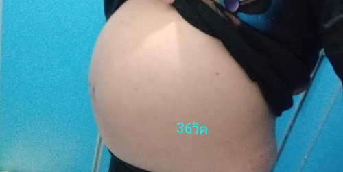 ลูกไม่ค่อยดิ้น