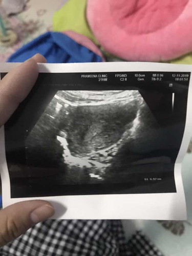 มีเลือดหลังจากมีเพศสัมพันธ์ค่ะ