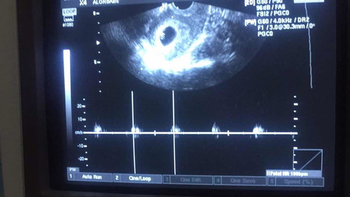 my baby @ week 6?