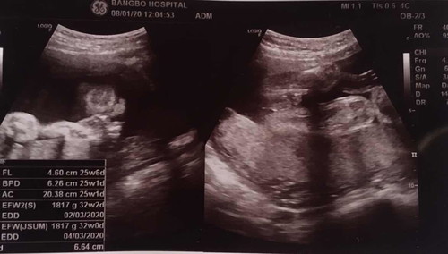 25+4 ลูกชาย