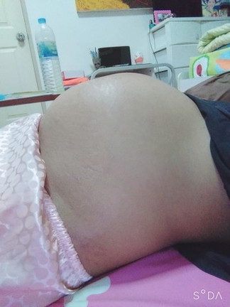 การนอน