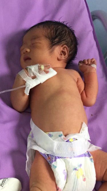 ได้เจอกันแค่แป๊บเดียวคะ 38+2w น้องกัปตัน เพศชาย 10/3/63