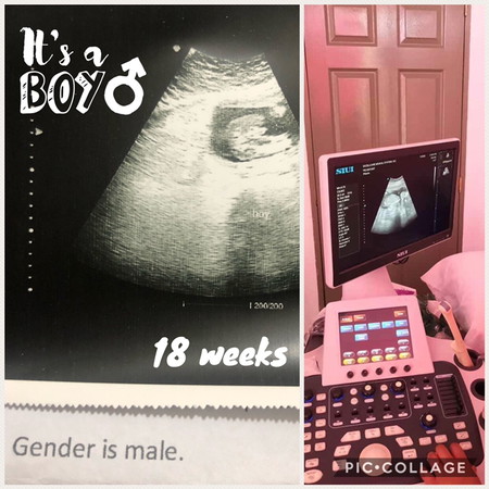 It’s a boy! ❤️