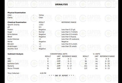 urinalysis