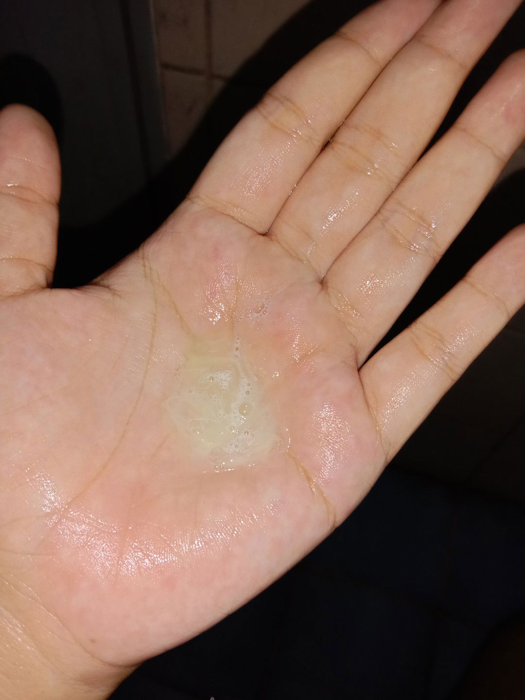 คุณเเม่ทุกคนค้ะสอบถามหน่อยค่ะ มีเเบบนี้ออกมาคือว่าอะไรค้ะต้องไปหาหมอไหม