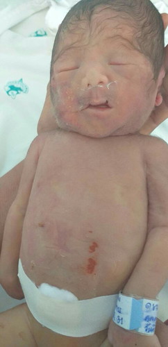 ขอเล่าประสบการณ์คลอดก่อนกำหนดนะคะ