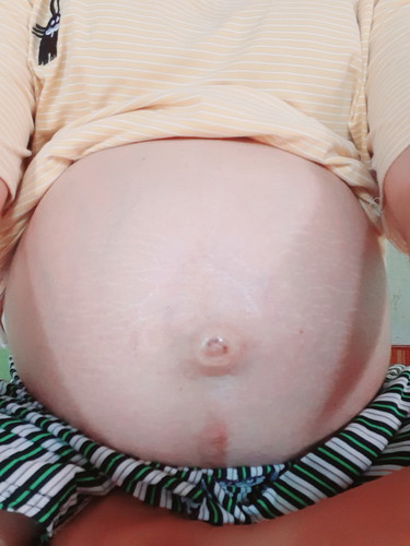 32 วีค ค่ะแม่ๆ