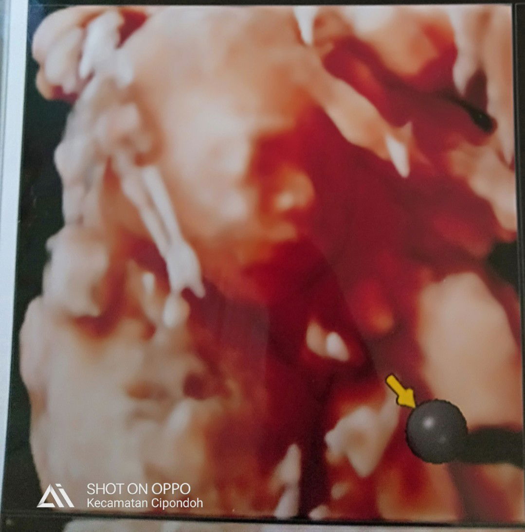 ɨʄa ċaʏaռҡ profile icon