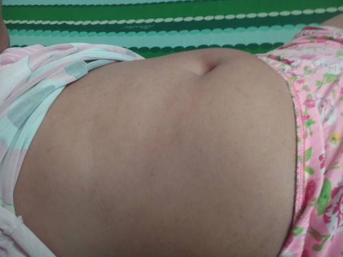 masakit ang puson