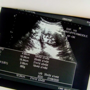 ตั้งครรภ์