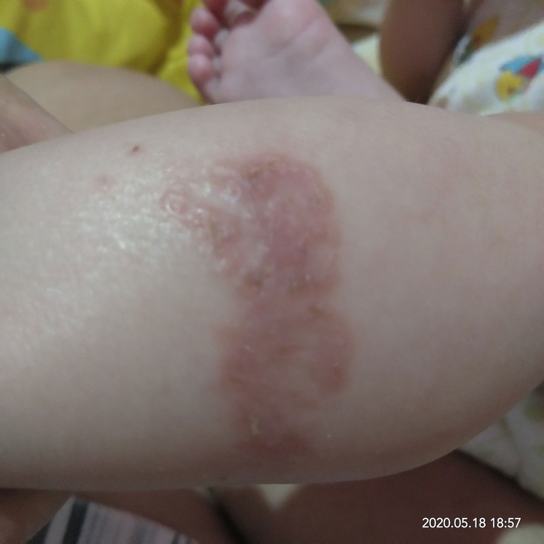 kulit bayi