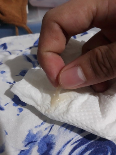 mucus plug