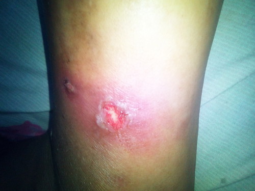 bingung ni kaki kenapa ada yg tau obat nya gak
