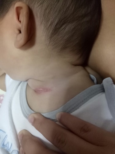 คอน้องเป็นแบบนี้มา หลายเดือนแล้ว