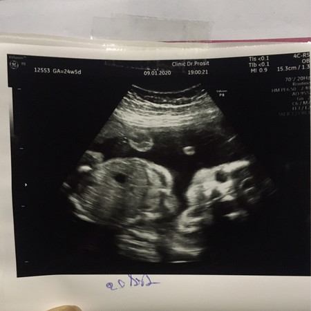 สอบถามค่ะ