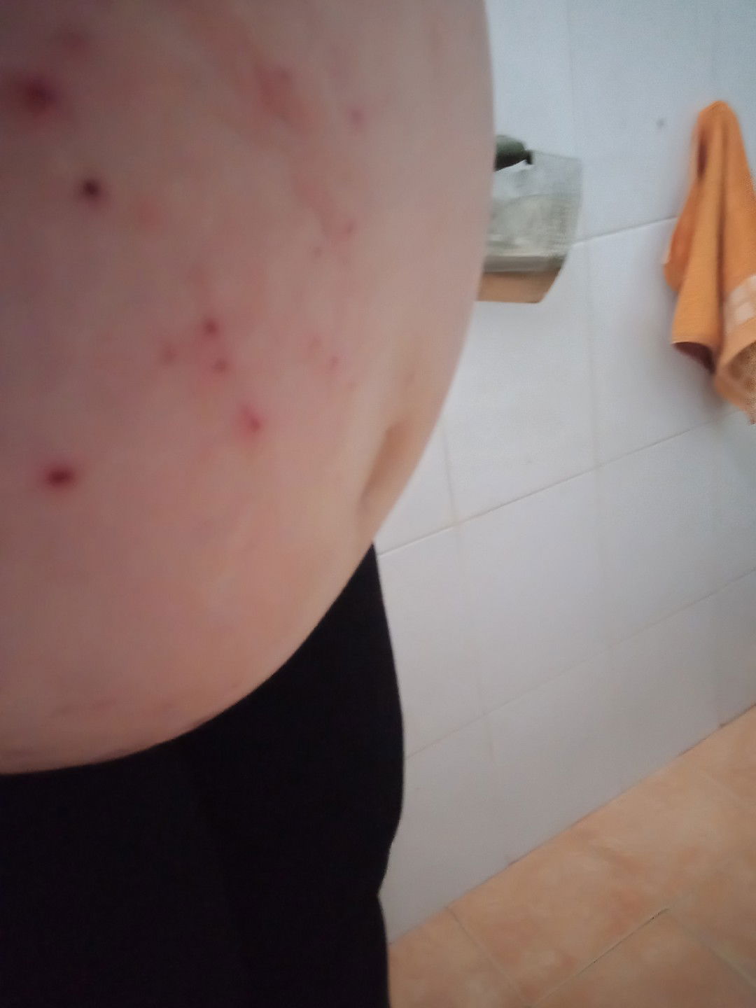 ngứa quá các mẹ ạ