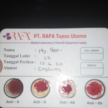 epek bidan lupa ngasih tau , ,