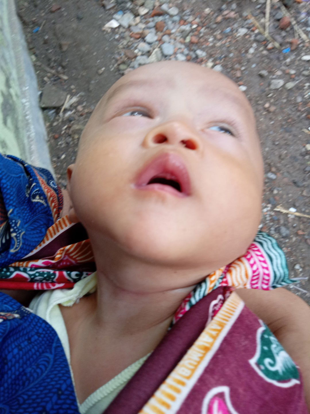 kepala mendongak ke atas