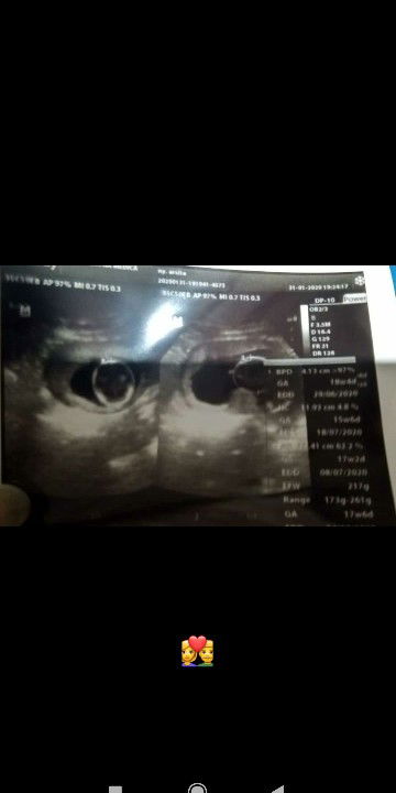 berat badan janin UK 17week