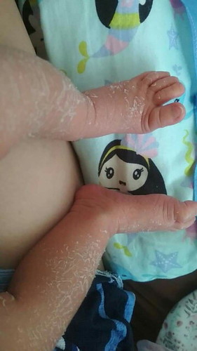 Baby Skin