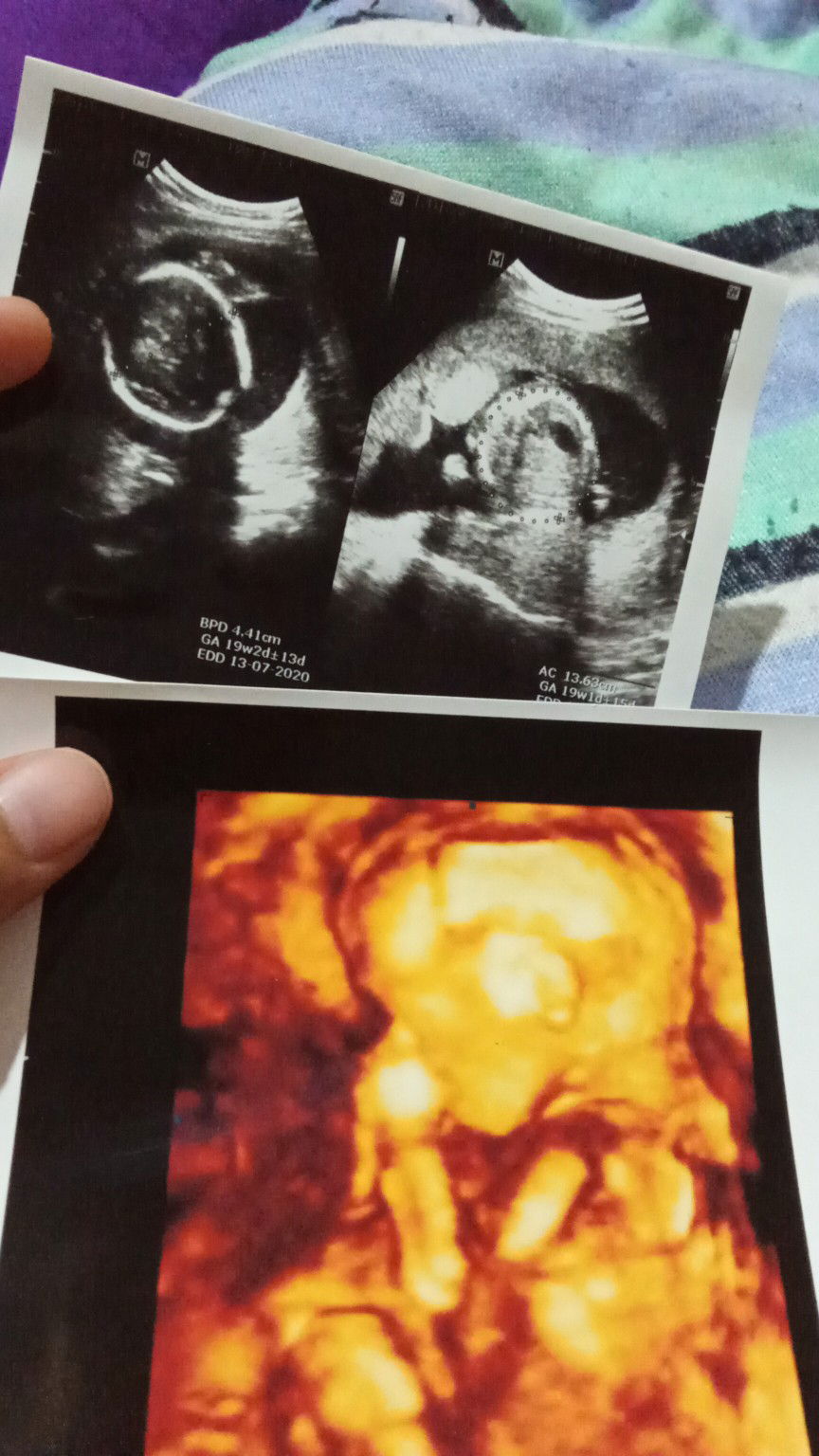 19w4d