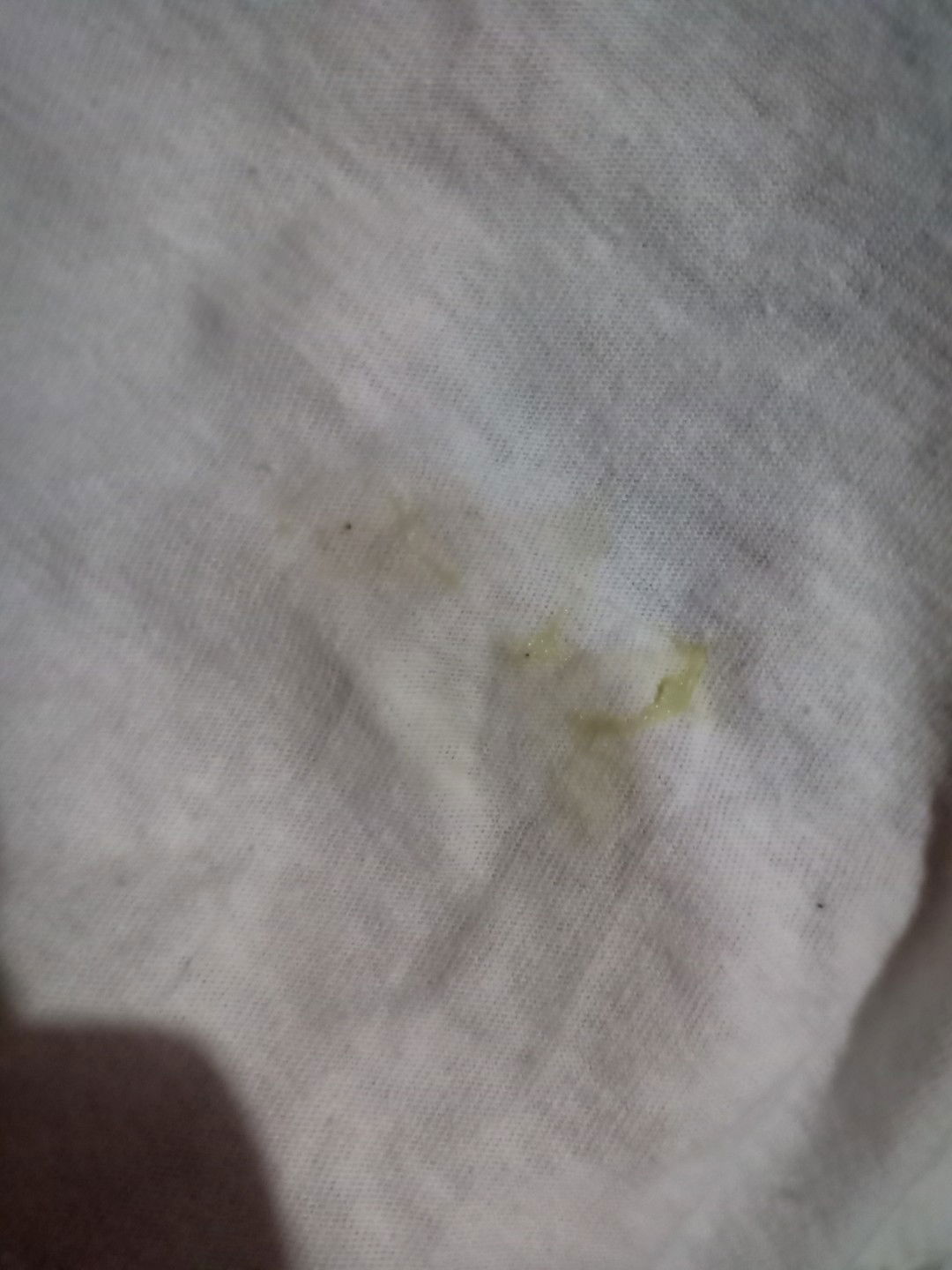 Ano to? NORMAL Lang po ba?