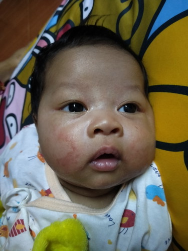 2เดือน