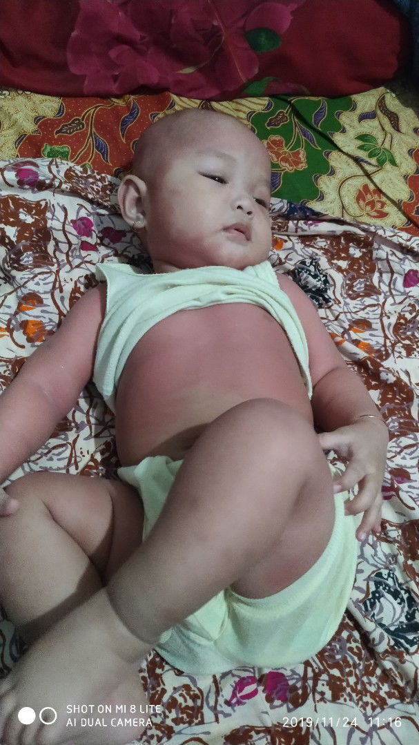 badan bayi memerah