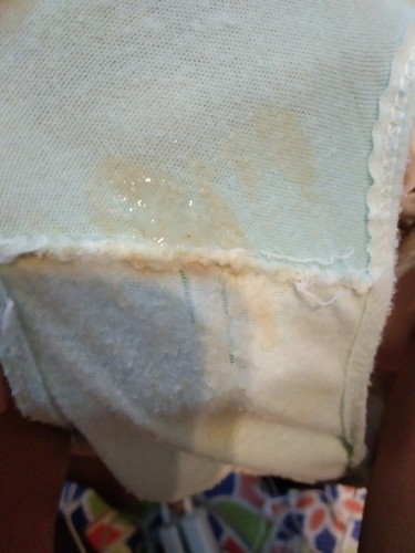 มูกหรือตกขาว