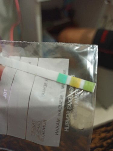 protein urin positif