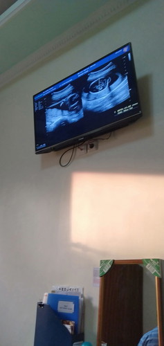 Placenta previa.. tiap hari keluar flek tanpa rasa sakit.. apakah bahaya