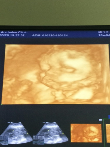 แม่ๆคลอดกันกี่วีคค่ะ