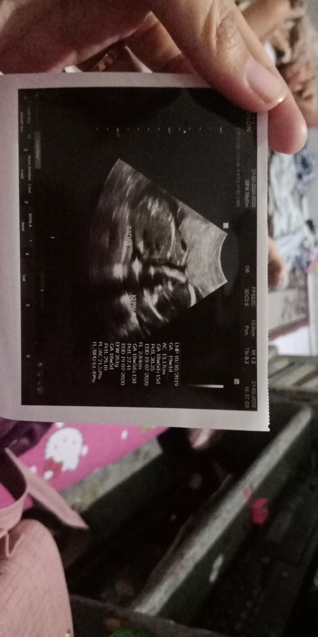 Blum ngerasain gerakan baby