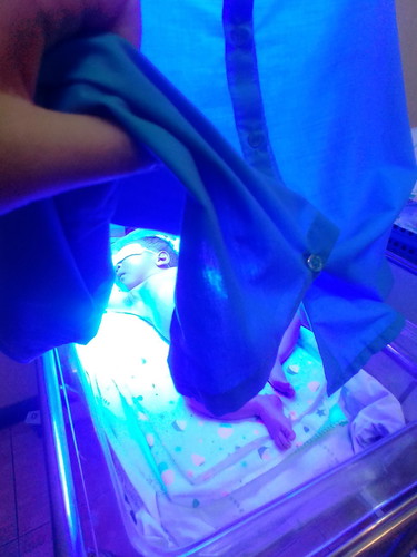 ส่องไฟตัวเหลือง คุณแม่มือใหม่