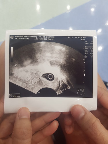 แบบนี้มีตัวไหน ระหว่างรอหมอ ซาวแล้วยังไม่พบหมอ