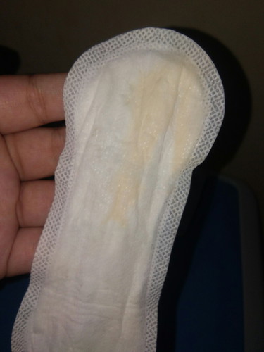 normal lng po vha toh..