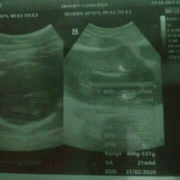 bhagian nya menjadi ibu