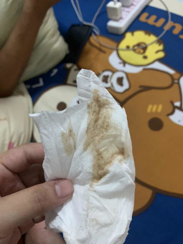 ตกขาวสีน้ำตาล