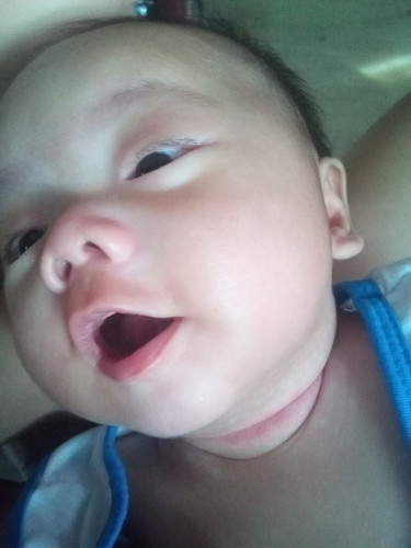 rashes sa leeg