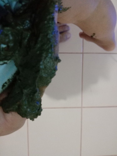 อึของลูกวัย1ขวบครึ่ง/อาการไอของลูก