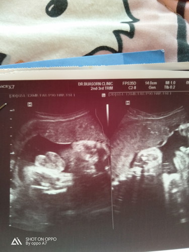 ถามแม่ๆหน่อยค่ะ