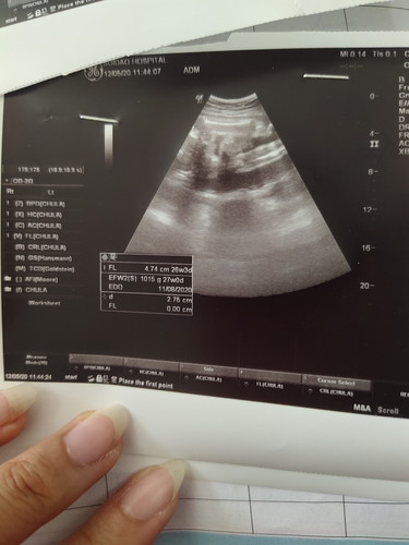 ใบซาวน์ใครตรงกับจำนวนweekลูกบ้าง