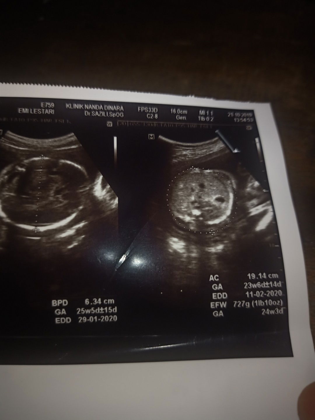 bunda mau tanya dong ini hpl nya tgl brp ya gak paham baca hasil usg soalnya hehe