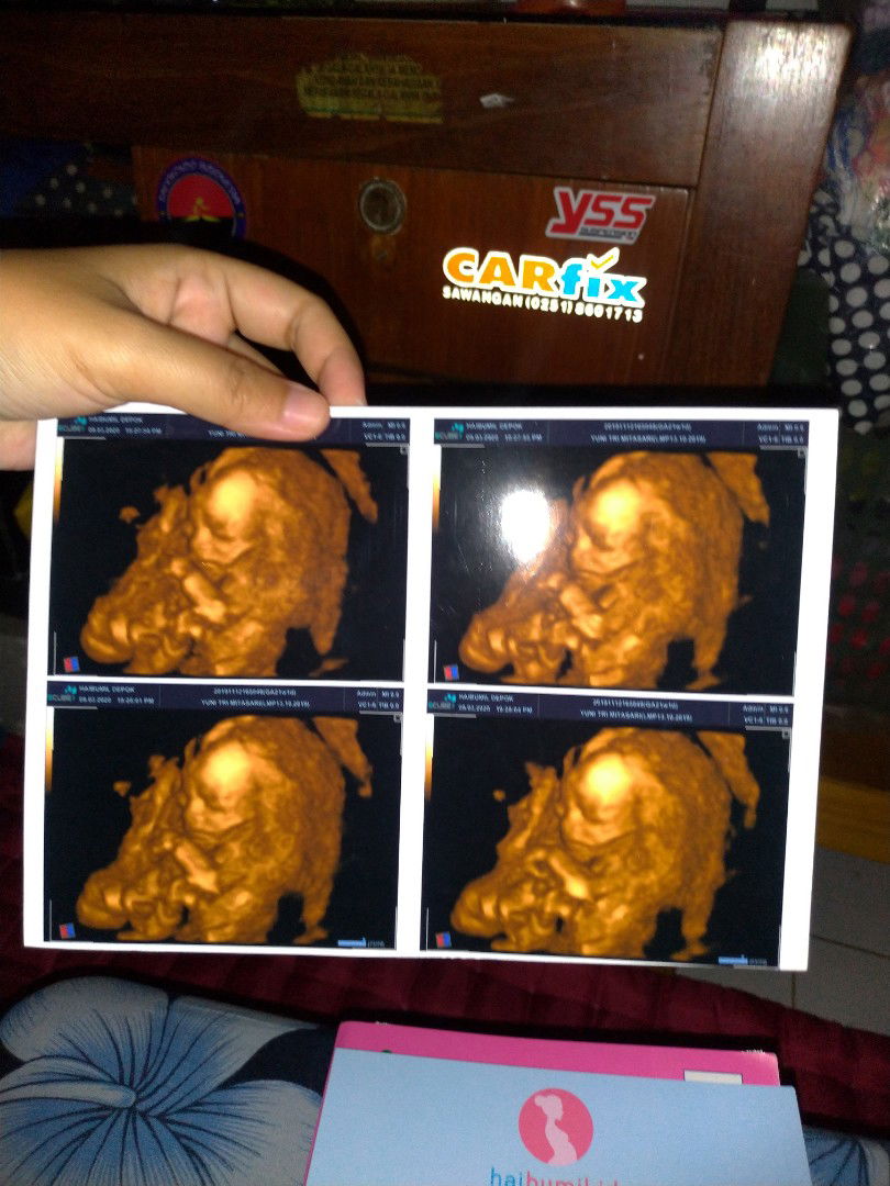 Pengalaman Hamil Pertamaku (Tidak Promil)