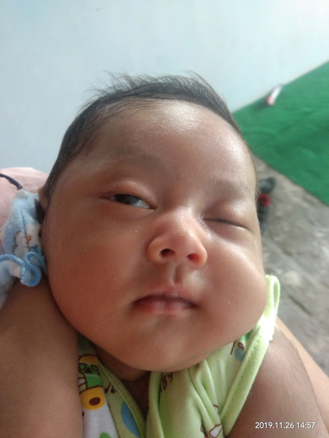 imunisasi lewat bulan