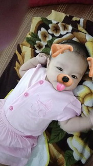 bé nhà e đầu bị lép thì phải làm gì để ko bị lép nữa ạ