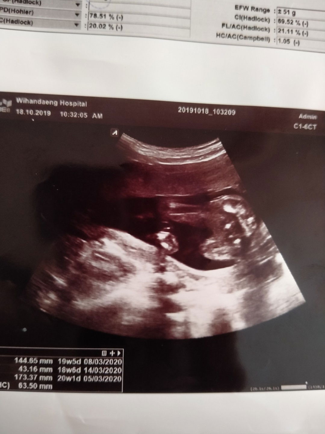 #แม่ๆบ้านไหนดูเป็นบ่างคะ