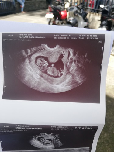 12weeks & 2days!